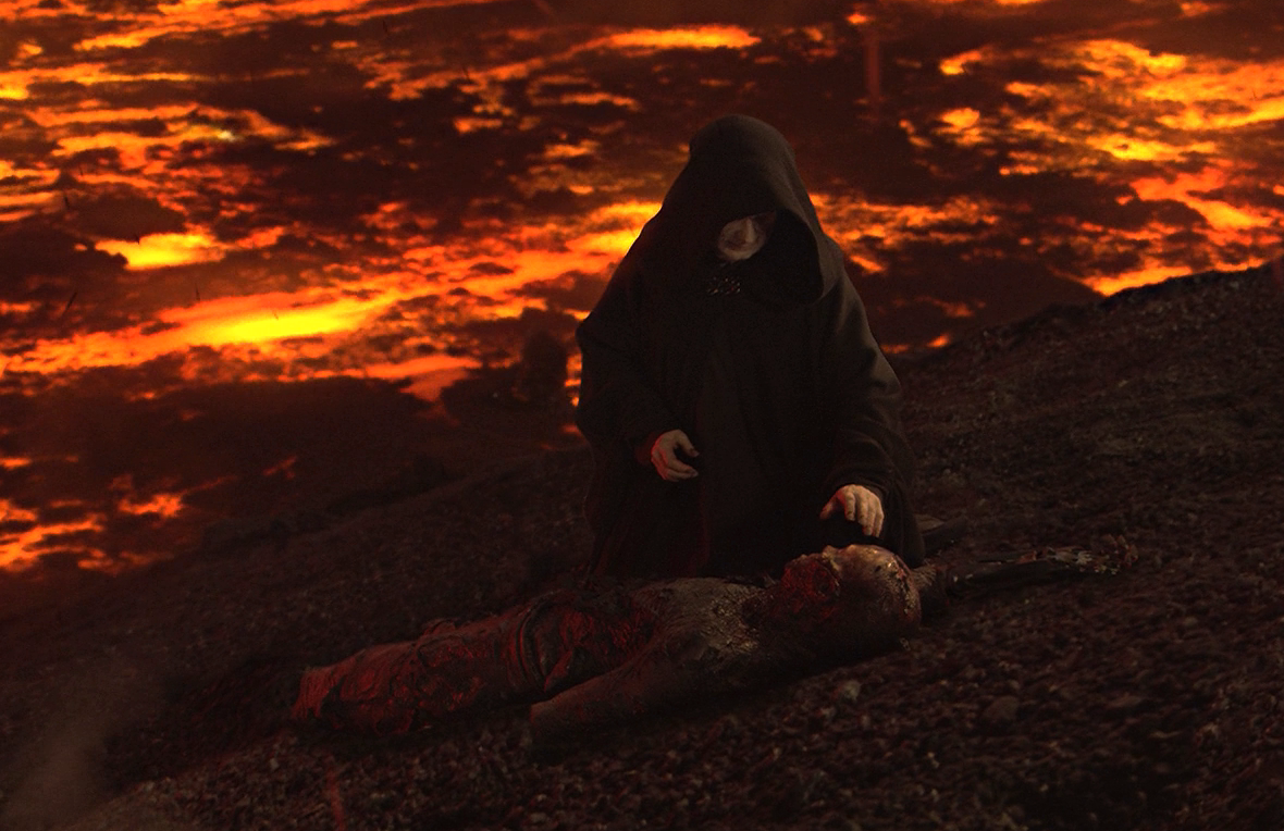 anakin skywalker burned.png